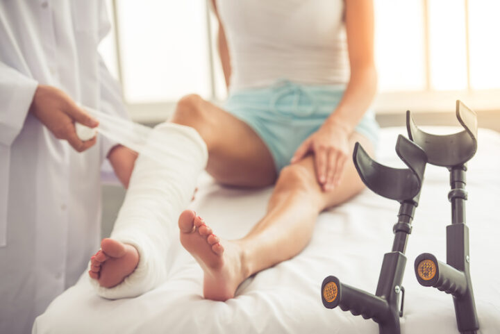 Cropped image of a doctor bandaging woman's broken leg.