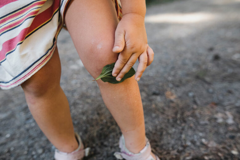 Little girl covering scratch on knee with leaf